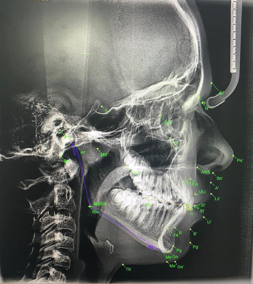 Dentavid Rx – Radiologie dentară digitala Turda – Radiografii dentare 3D